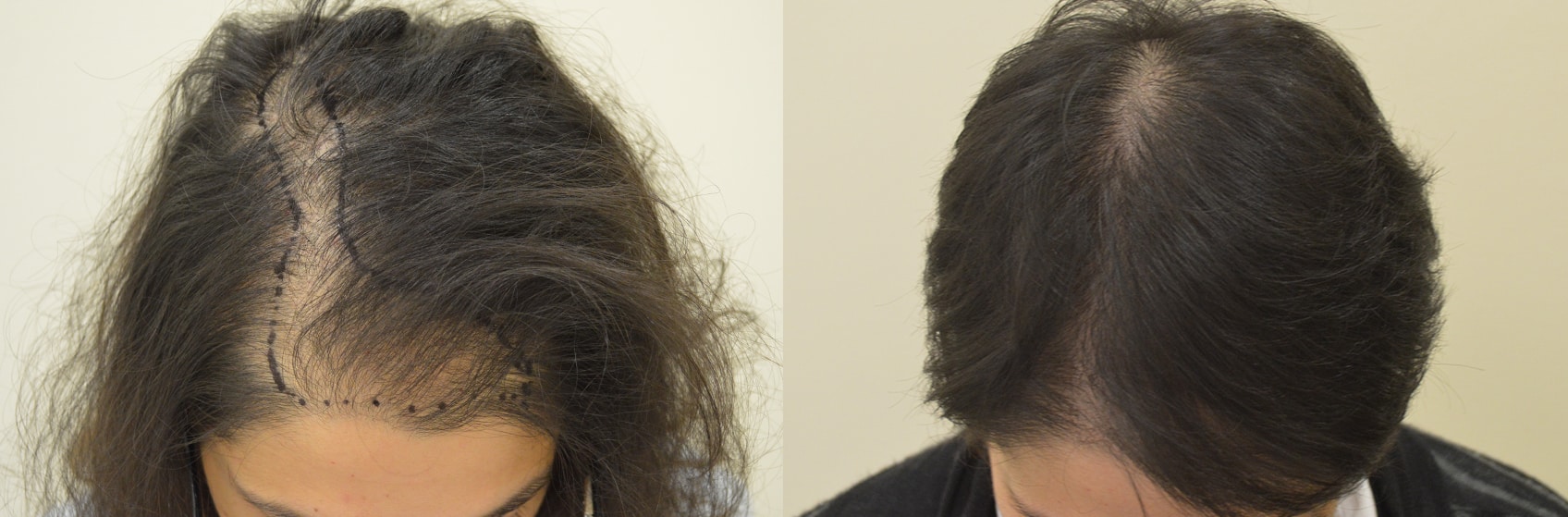 Istituto Helvetico Sanders per il benessere dei nostri capelli 5