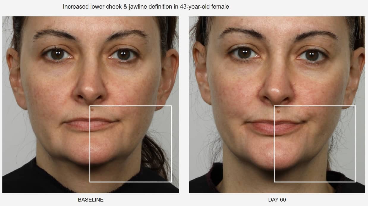Trattamenti viso anti age: la mia esperienza con NUFACE Trinity® 3